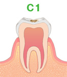 c1